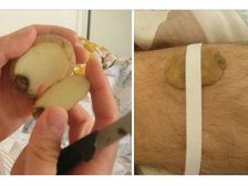 ఆరోగ్య సమస్యలకు మన పూర్వీకులు ఉపయోగించే కొన్ని విచిత్రమైన నివారణలు!