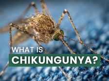 చికున్‌గున్యా అంటే ఏమిటి? కారణాలు, లక్షణాలు, సమస్యలు, చికిత్సలు మరియు నివారణ