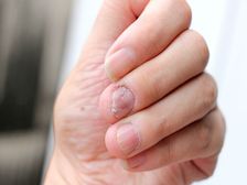 Covid Nails: కరోనా వచ్చి వెళ్ళిందని మీ గోర్లు కూడా తెలుపుతాయి.. ఎలాగో మీకు తెలుసా?