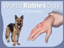 World Rabies Day 2021: కుక్క కాటు తర్వాత రేబీస్ రాకుండా ఉండాలంటే...