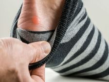 బొబ్బలు చాలా సాధారణ సమస్య :ఇంట్లో బొబ్బలు వదిలించుకోవడానికి ఉత్తమమైన 6 మార్గాలు!