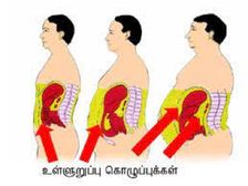 Weight loss:  మీ శరీరంలోని కొవ్వు రకాలు మరియు అది మీ జీవితానికి ఎలాంటి ప్రమాదాన్ని కలిగిస్తుందో మీకు తెలుసా?