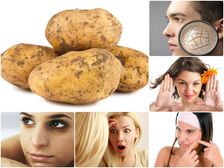 ఈ సమస్యలన్నింటికీ బంగాళదుంపలతో పరిష్కారాలు..బ్యూటీ విషయంలో మ్యాజిక్ చేస్తుంది..