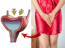 మూత్రాశయ ఆరోగ్యాన్ని క్షీణింపజేసి, తరచుగా మూత్రవిసర్జనకు కారణమయ్యే ఆహారాలు!