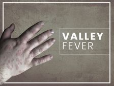 Rift Valley Fever:RVF ఫీవర్ అంటే ఏమిటి? దాని లక్షణాలు, ట్రీట్మెంట్ ఎలాగో తెలుసుకోండి...