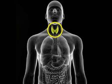 Hypothyroidism: థైరాయిడ్ బాధితులు బరువు తగ్గాలంటే.. ఇలా చేయండి