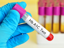 HbA1c Test for Diabetes: డయాబెటిక్ పేషెంట్లు ప్రతి 3 నెలలకోసారి HbA1c టెస్ట్ ఎందుకు చేయించుకోవాలో తెలుసా?