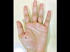 చేతిపై పుట్టుమచ్చలు ఉన్నఈ ప్రదేశాన్ని బట్టి అది శుభమో, అశుభమో తెలియజేస్తాయి..