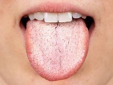 Oral Health: మీ నోరు ఇలా ఉంది అంటే.. మీ శరీరంలో ఏదో పెద్ద సమస్య ఉందని అర్థం.. జాగ్రత్త...!!