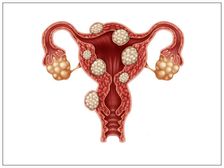 Fibroids during pregnancy: మీకు ఫైబ్రాయిడ్లు ఉంటే గర్భం దాల్చడంలో ఏవైనా సమస్యలు వస్తాయా?