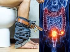 ఈ లక్షణాలు మీలో కనిపిస్తున్నాయా..? అలాంటప్పుడు అది ప్రమాదకరమైన క్యాన్సర్‌కు సంకేతం... జాగ్రత్త!