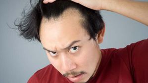 కూల్ డ్రింక్స్ తాగితే పురుషుల్లో జుట్టు రాలుతుందా? 