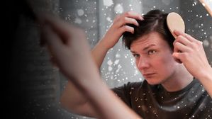 చలికాలంలో అధిక జుట్టు రాలడాన్ని ఎదుర్కొనే పురుషులు తప్పనిసరిగా అనుసరించాల్సినది!