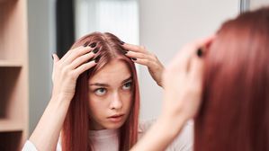 మీ తలలో మొటిమలు ఉన్నాయా?మొటిమలు దురుదపెడుతున్నాయా? వాటికి కారణాలు, నివారణ ఇక్కడ తెలుసుకోండి!