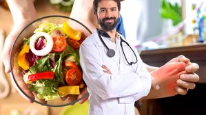 Diet for High uric acid: కీళ్ళనొప్పులు, కిడ్నీ స్టోన్స్ కు కారణం అయ్యే హై యూరిక్ యాసిడ్ తగ్గించే బెస్ట్ ఫుడ్