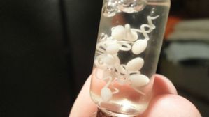 జెంటిల్మెన్! మీ స్పెర్మ్ నీరుల కనిపిస్తుందా? ఇలా పరిష్కరించుకోండి