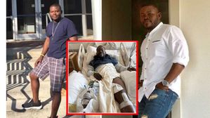 Lengthening Surgery: అమ్మాయిలు డేటింగ్‌కు రావట్లేదని కోట్లు ఖర్చు పెట్టి హైట్ పెరిగాడు