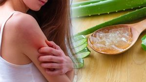 Home Remedies for Sweat Rash: చెమట దద్దుర్లు(చెమటకాయలు) లేదా వేడి దద్దుర్లు నివారించడానికి ఇంటి నివారణలు