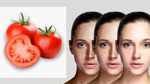 ముఖంలో మొటిమలు, స్కిన్ పిగ్మెంటేషన్ నివారించడానికి టమోటో ఇలా వాడండి..