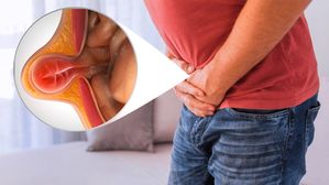 Hernia: ఈ సమస్య స్త్రీల కంటే పురుషుల్లోనే ఎక్కువ.. ఎందుకో తెలుసా? 
