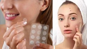 Pimple Patches: మొటిమలు ఇబ్బంది పెడుతున్నాయా? ఈ పింపుల్ ప్యాచెస్ వాడితే మచ్చలు పడకుండా తొలగిపోతాయి