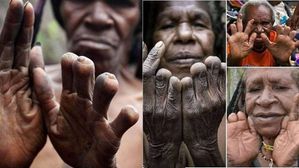 ఇంట్లో వాళ్లు చనిపోతే బతికున్న వారి చేతివేళ్లు కట్ చేస్తారు, భయంకరమైన ఈ ఆచారం ఎక్కడంటే..