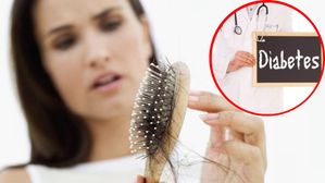 డయాబెటిస్‌తో హెయిర్ లాస్.. జుట్టు రాలకూడదంటే ఈ చిట్కాలు పాటించండి
