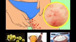 తొడల లోపలి దురద,రాషెస్? దీన్ని వదిలించుకోవడానికి ఇక్కడ కొన్ని సాధారణ మార్గాలు ఉన్నాయి!