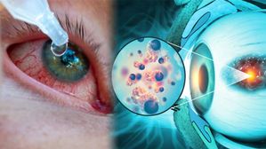 Myths and Facts about Pink Eye:ఐ ఫ్లూ & పింక్ ఐ: అపోహలు vs వాస్తవాలు: కళ్లను చూడటం వల్ల కూడా ఐ ఫ్లూ వస్తుందా?