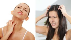 వర్షాకాలంలో వేధించే చర్మ, జుట్టు అలెర్జీలు.. వాటి పరిష్కారాలు