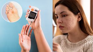 హెచ్చరిక! మీ చర్మంపై ఈ లక్షణాలు ఉన్నాయా? అయితే మీ శరీరంలో షుగర్ లెవల్స్ ఎక్కువగా ఉన్నట్లే..!