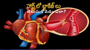 World Heart Day 2023: గుండె రక్తనాళంలో అడ్డంకులు ఏర్పడినప్పుడు ముందుగానే గుర్తించడం ఎలా?