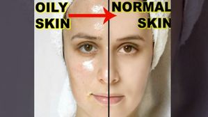 Oil Skin: జిడ్డు చర్మాన్ని క్లియర్ చేయడానికి ఈఫేస్ మాస్క్‌లను ట్రై చేయండి!