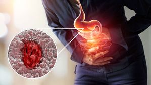 Stomach Ulcer: స్టొమక్ అల్సర్(అల్సర్ )కి ముఖ్యమైన కారణాలు!!