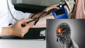 World Stroke Day 2023: రక్తపోటు పెరుగుదల కారణంగా స్ట్రోక్ ప్రమాదం పెరుగుతుంది, నిపుణుల నుండి నివారణ పద్ధతి