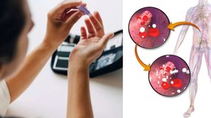 రక్తంలో చక్కెర స్థాయి పెరగకుండా ఉండాలంటే ఏమి చేయాలి ?