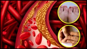 మీ గోళ్లు ఇలా ఉన్నాయా? కొలెస్ట్రాల్ ప్రమాదకర స్థితిలో ఉందని అర్థం..ఈ లక్షణాలతో మగవారు జాగ్రత్త