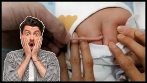 మిరాకిల్: 4 అంగుళాల తోకతో పుట్టిన బేబీ... తోక తీసేస్తారా? వైద్యులు ఏమంటున్నారు?
