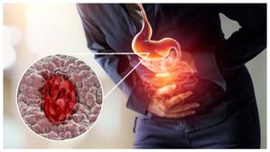 ఈ అలవాట్లు ఉన్నవారికి తీవ్ర కడుపులో అల్సర్ వచ్చే అవకాశం ఉంది...వెంటనే బయటపడండి...!