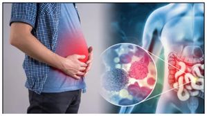Prostate Cancer: ప్రొస్టేట్ క్యాన్సర్ ఏ వయస్సు పురుషుల్లో ఎక్కువ వస్తుంది..ఎలాంటి జాగ్రత్తలు తీసుకోవాలి?