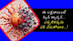 ఈ లక్షణాలుంటే స్కిన్ క్యాన్సర్.. ఎప్పటికప్పుడు చెక్ చేసుకోవాలి..!