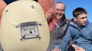 బ్రెయిన్ ఇంప్లాంట్ ద్వారా మూర్ఛ వ్యాధికి చెక్.. ప్రపంచంలోనే మొదటి సర్జరీ సక్సస్..!