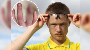 చేతి వేలునే కట్ చేసుకున్న పారిస్ ఒలింపిక్స్ ఆటగాడు.. ఎందుకో తెలిస్తే శభాష్ అంటారు..!!