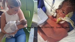 పిల్లలలో సీతాకోకచిలుక చర్మ వ్యాధి! ప్రాణాలు తీసే ఎపిడెర్మోలిసిస్ బులోసా లక్షణాలు, నివారణ