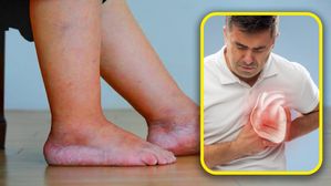 గుండెపోటుకు ముందు కాళ్లలో కనిపించే 5 లక్షణాలు; నిర్లక్ష్యం చేయకుండా సమయానికి అప్రమత్తంగా ఉండండి