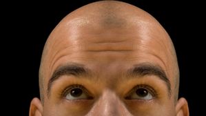 పాతికేళ్లకే బట్టతల రాకుండా ఉండాలంటే.. ఉదయాన్నే ఈ పని చేస్తే సరిపోతుంది!