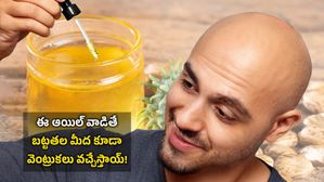Best oil for hair problem:  ఈ ఆయిల్ వాడితే బట్టతల మీద కూడా వెంట్రుకలు వచ్చేస్తాయ్!