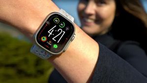 Smart Watches: స్మార్ట్ వాచ్‌లు పెట్టుకుంటున్నారా? అయితే ఈ రోగాలు రావడం ఖాయం!