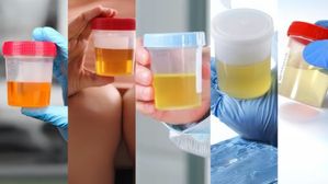 మీ మూత్రం ఏ రంగులో ఉందో గమనించారా?.. ఈ రంగుల్లో ఉంటే మాత్రం కచ్చితంగా రోగం ఉన్నట్లే!