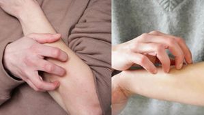 గోకుడు వల్ల బోలెడు ప్రయోజనాలు..పరిశోధనలో కీలక విషయాలు వెలుగులోకి